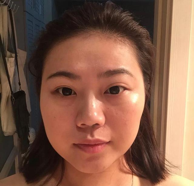 判断你是不是大小脸面部不对称是关键看这几点就知道