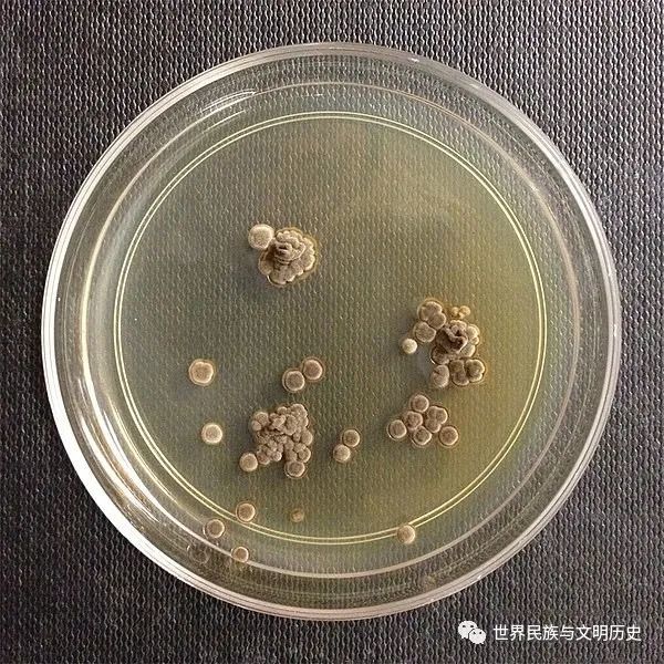 伞菌亚门(agaricomycotina) 柄锈菌亚门(pucciniomycotina) 黑粉菌