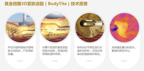 面部吸脂?黄金微雕?钻石精雕?傻傻分不清