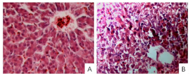 肝脏切片:图a对照组,图b试验组