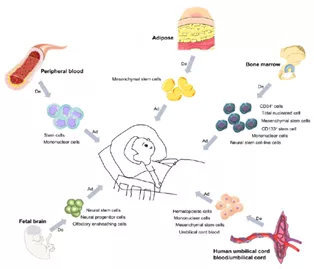 我国间充质干细胞治疗脑瘫:12名患儿接受治疗后得到满意结果