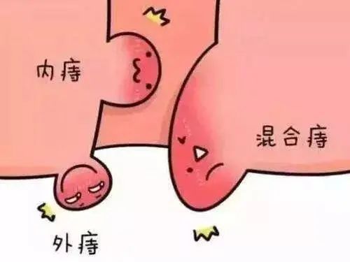 肉团脱垂于肛门外,摸上去软软的,肉团颜色鲜红.