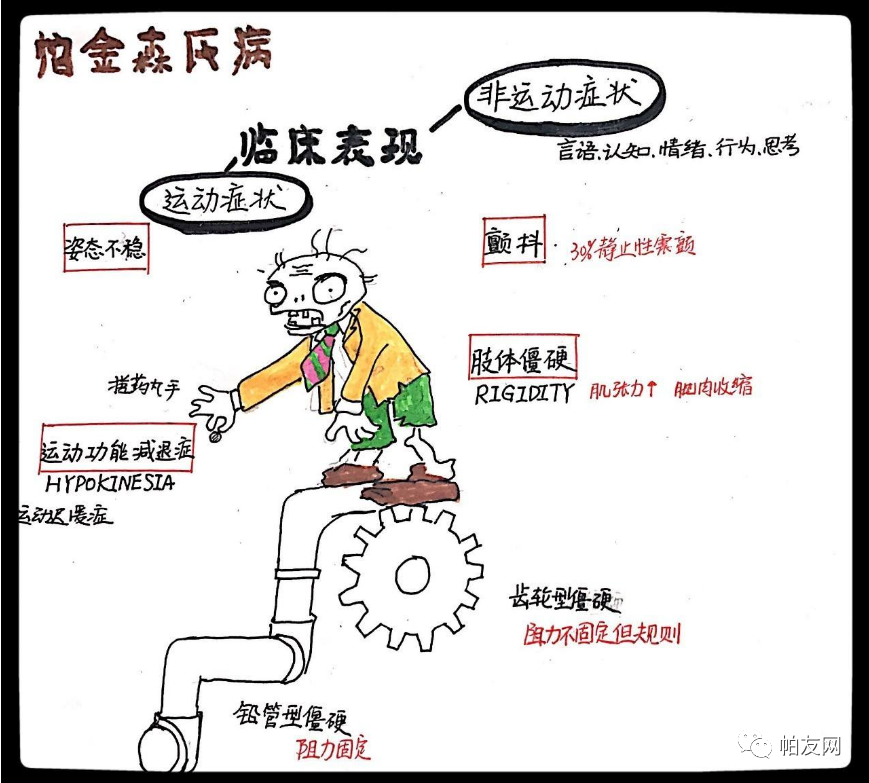 帕金森是什么病（帕金森是什么病_有什么症状_）