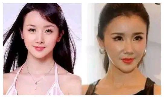 整容失败的5位女明星,第2位越来越像男人,第5位像老巫婆