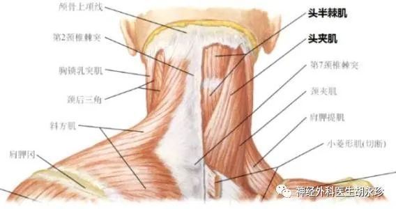 后者包括头最长肌,斜方肌,颈最长肌,头夹肌,颈夹肌,肩胛提肌,后斜角
