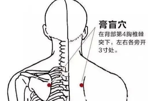 【3】膏盲穴 膏肓穴归属足太阳膀胱经,有治疗咳嗽,气喘,支气管炎,肺