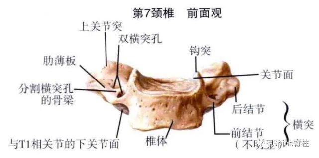 人体颈椎的冰冻解剖切片和示意图显示的钩突裂隙