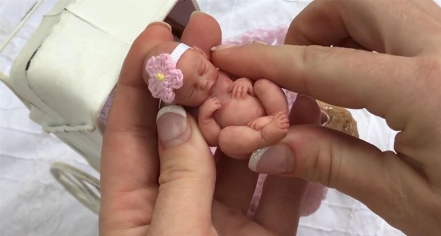生命奇迹世界最小婴儿出生仅25厘米如今18岁的她怎样了