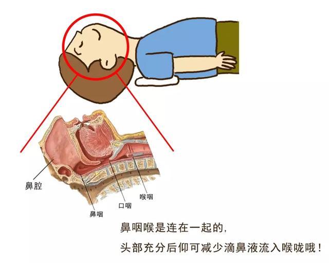 收藏!鼻腔用药的正确方法