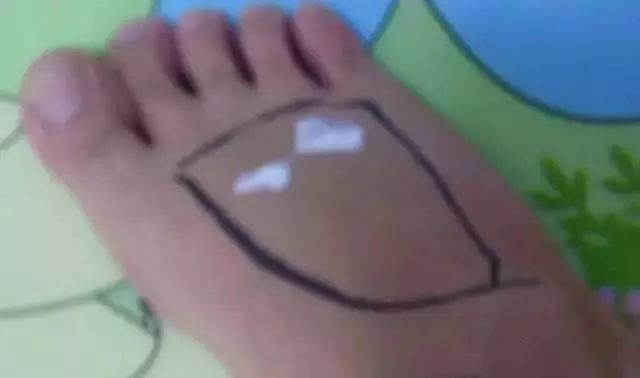 乳腺增生怎样治愈（乳腺增生怎样治愈有什么偏方）