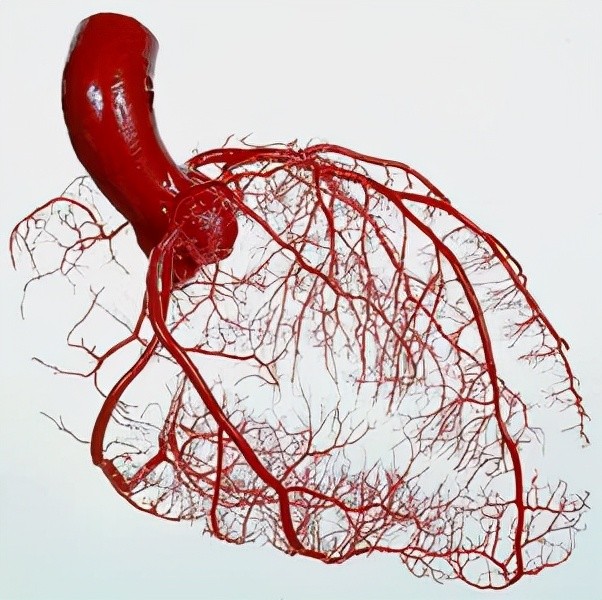 冠状动脉狭窄病变,越是近段,越是靠近开口,对整个血管供血的影响就越