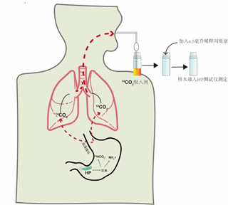 幽门螺旋杆菌阳性是什么意思（幽门螺旋杆菌阳性是什么意思严重吗）