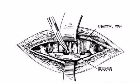 腰椎病怎么治疗（腰椎病怎么治疗最好的方法）