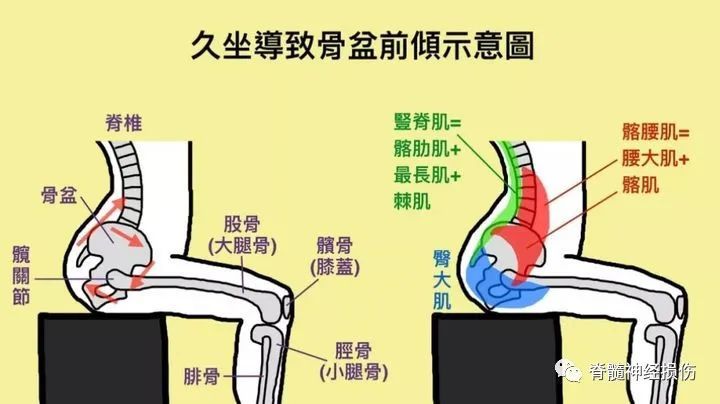 久坐的危害有哪些?