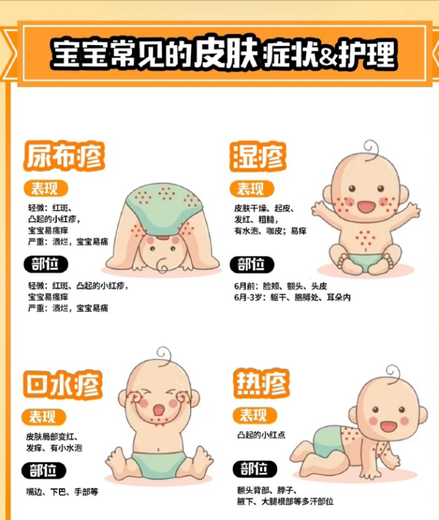 科普:幼儿急疹出疹后如何护理?
