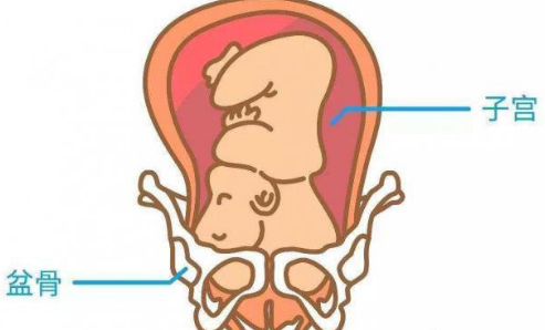 【出现哪些情况说明胎儿已经入盆了?】