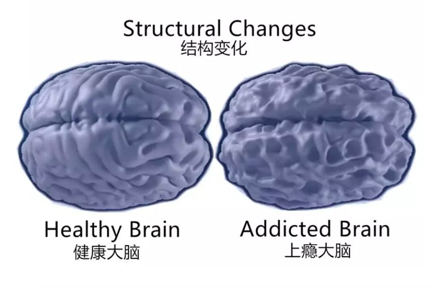 沉迷游戏的孩子大脑受损严重国家终于出手2亿父母点赞