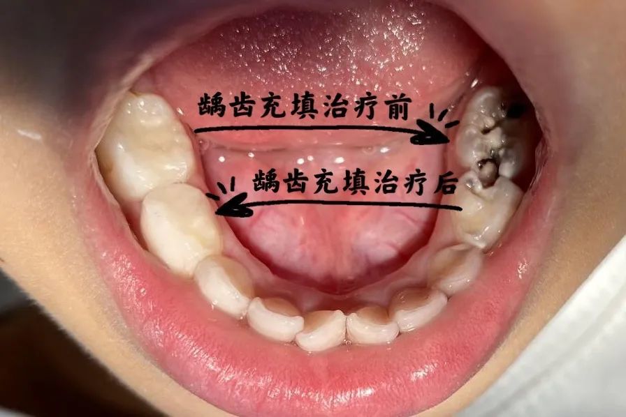 微导诊丨天津市第一中心医院儿童口腔门诊开诊