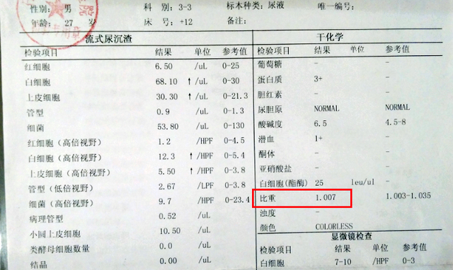 尿蛋白加号,定量,肌酐比,降到多少是达标?看看自己达标没