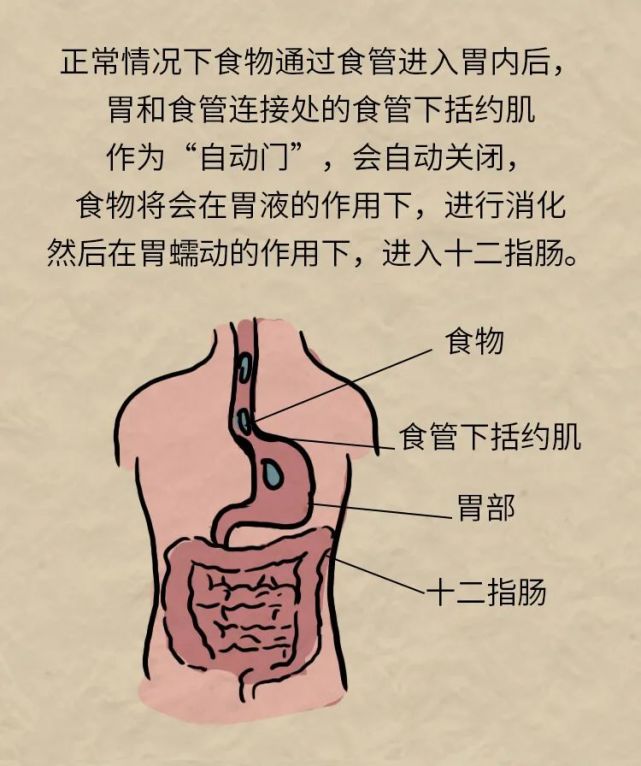 胃食管反流你必须知道的这几件事一图读懂