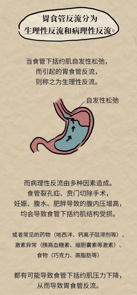 胃食管反流你必须知道的这几件事,一图读懂!