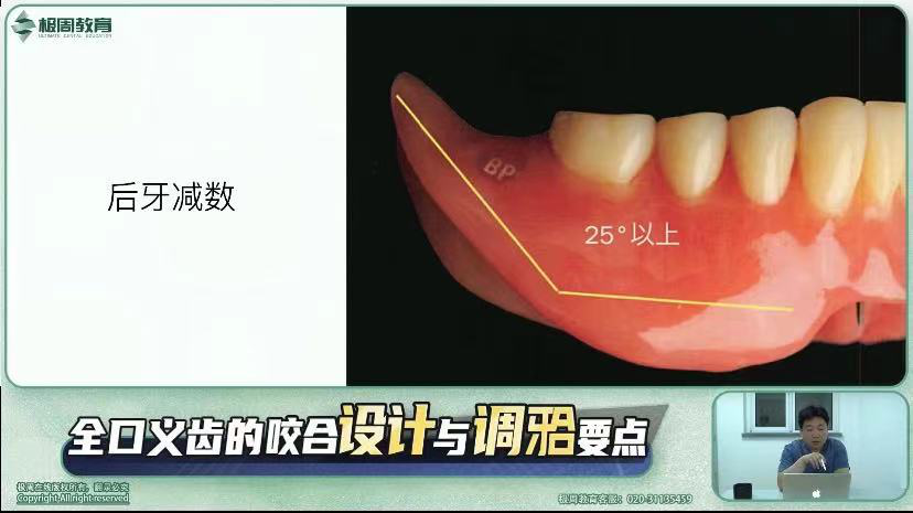 全口义齿设计与调