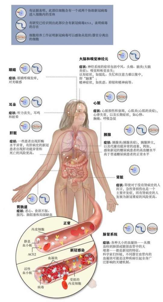 不止是肺炎新冠病毒可严重损害多个器官和组织