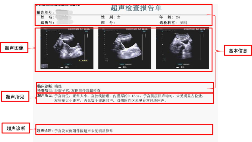 读懂体检单丨经常痛经,背后可能是可怕疾病!不要再忍