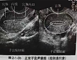 读懂体检单丨经常痛经,背后可能是可怕疾病!不要再忍