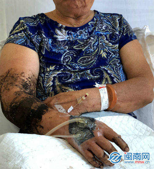 漳州一天出现多起蛇咬人事故|眼镜蛇|蛇出没|漳州|急诊医学科|银环蛇