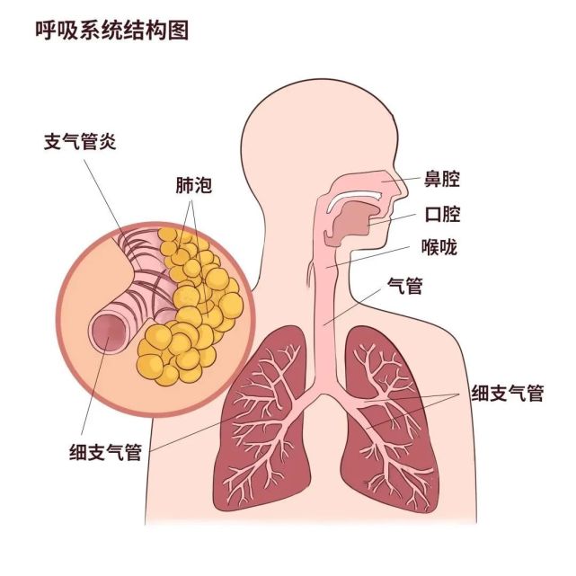 一到秋天宝宝咳嗽就不停可能是支气管炎在作怪