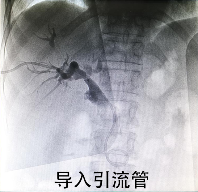 小黄人很危险ptcd来解决