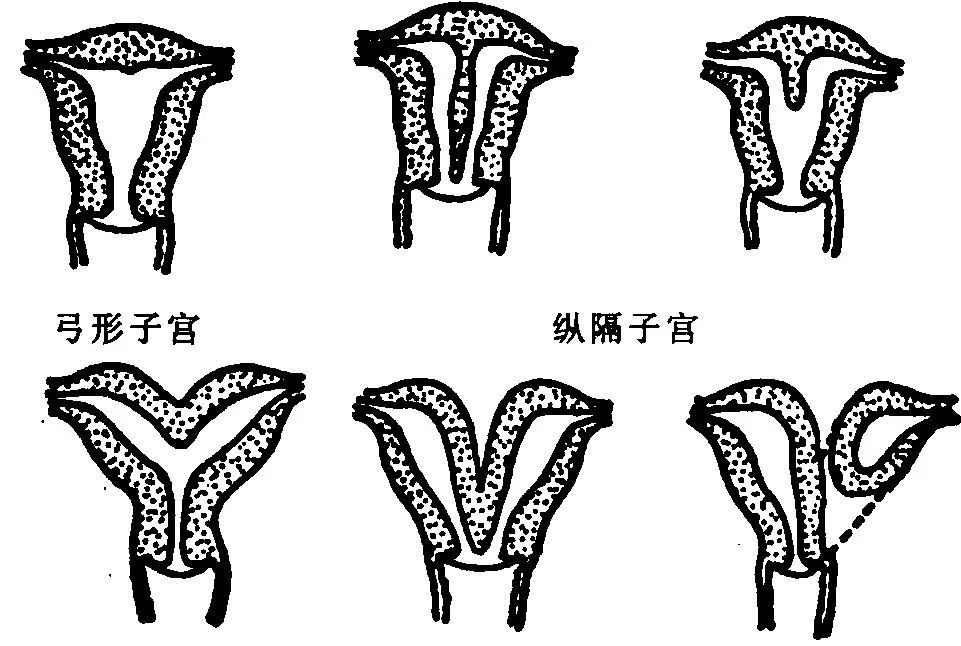 美亚科普4个角度全方位改善子宫环境轻松怀上宝宝