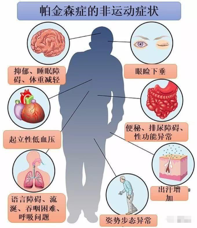 老年帕金森氏病的症状和治疗方法