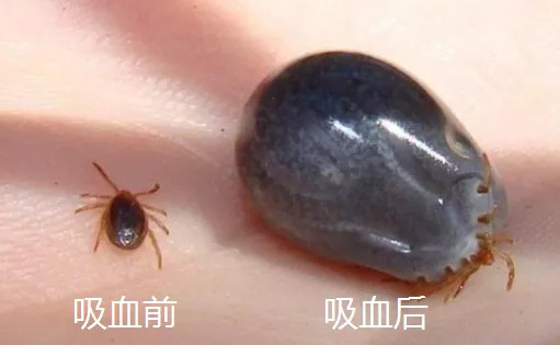 被蜱虫咬住,如何正确处理?