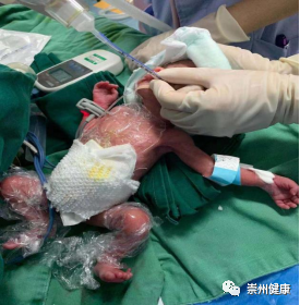 早产儿点点历险记