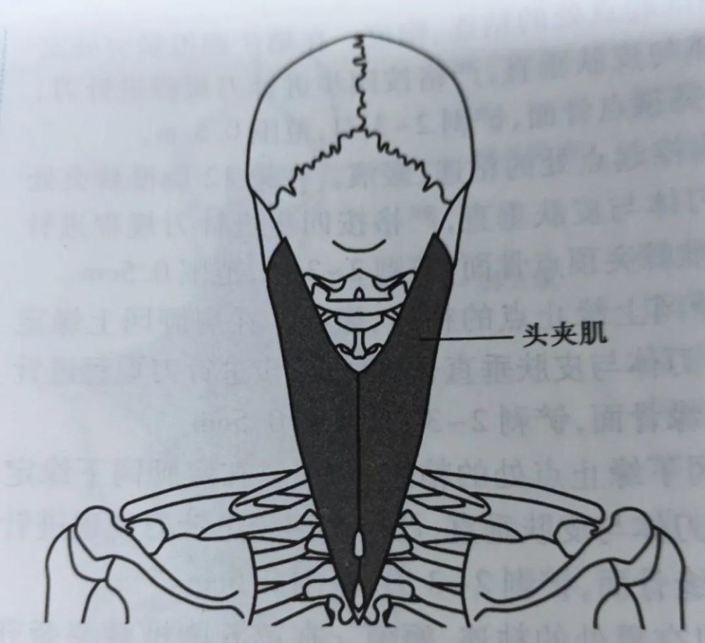 详解头夹肌损伤的针刀治疗