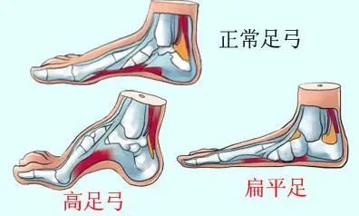 小皮鞋,很好看,可常常是鞋帮比较硬,这样很容易磨损孩子脚的跟腱部位