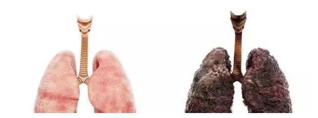 肺癌没什么可怕的主要心态好按时治疗可以恢复