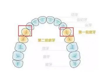 答:因为拔智齿和拔4号牙或5号牙(前磨牙)提供的间隙并不一致,拔一颗
