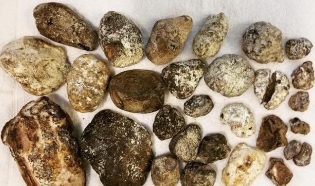鲸排泄物龙涎香数量巨大,为什么比"黄金"还贵?