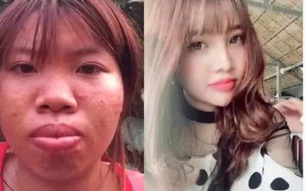 越南凤姐花8万元整容嫁进豪门,生下女儿后却惨遭抛弃,现状如何