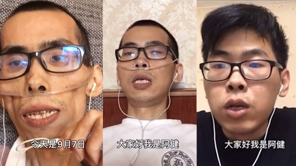 抗癌网红阿健离世,去世前坚持发视频,原因让人泪目_腾讯新闻