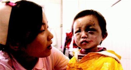 青海小苏丽:3岁被针线缝嘴,5岁被虐死,母亲出狱后将其