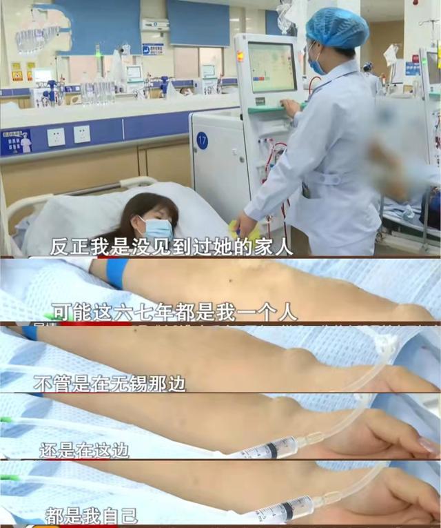 医生说,嘉妮现在病情严重,必须要靠透析续命.