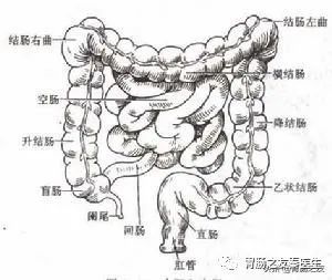 她的升结肠也就是阑尾开口往上右半结肠里面密密麻麻的都是结肠憩室