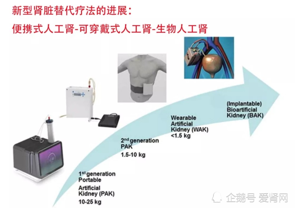 最全汇总各类人工肾临床应用要多久