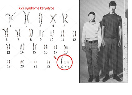 如果男性多一条y染色体会怎么样?1000人中有1个,比男人还男人