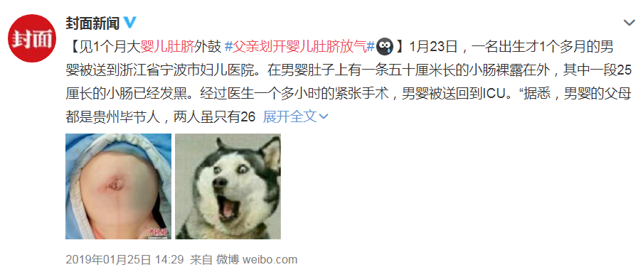 这是因为婴幼儿身体发育不完善,两侧的腹壁肌肉尚未发育成熟,肚脐位置