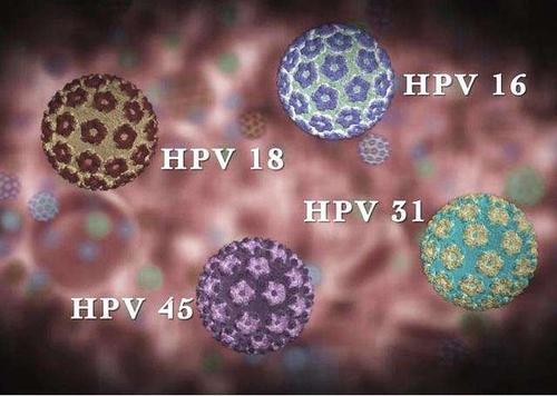 hpv病毒感染可以和宫颈癌划等号吗